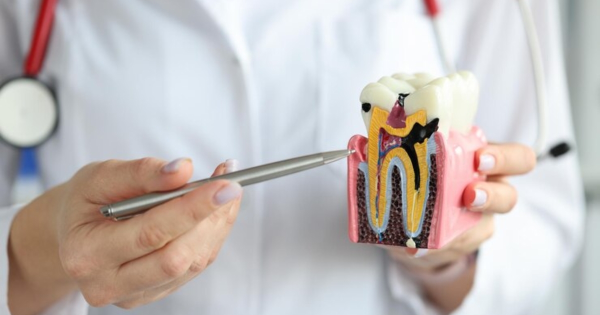 The Role of Nutrition in Root Canal Recovery for Residents of Charlotte